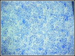 Island Batik, leaves design with medium blue background